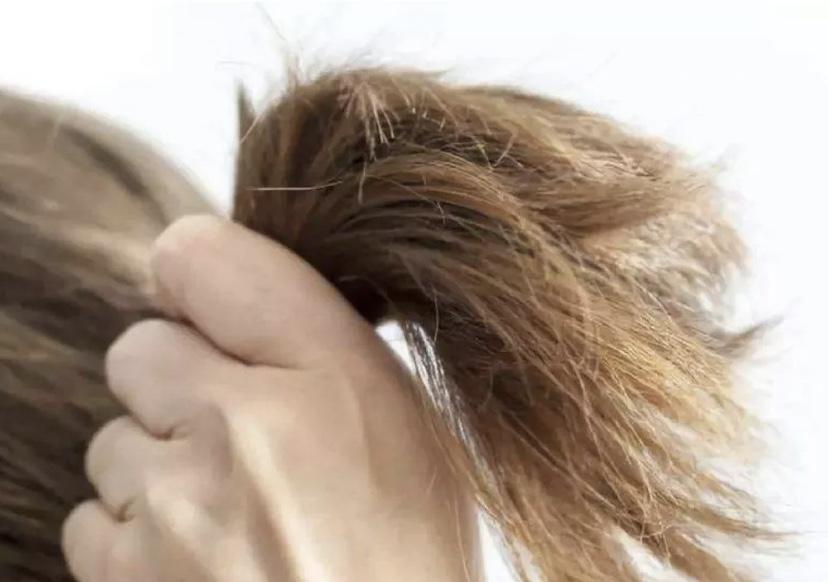 头发稀少油腻怎么办,头发干枯稀少油腻掉发怎么调理