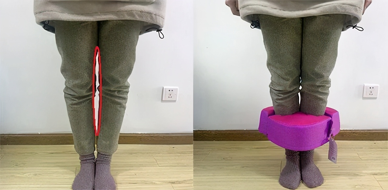 懒人腹肌贴真的能减肥吗,懒人腹肌贴多久能看到效果