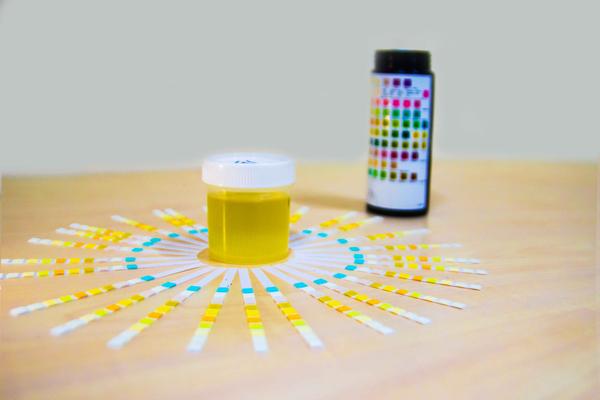 50岁男性预防体检必检项目一览表,男性25岁有必要做哪些检查