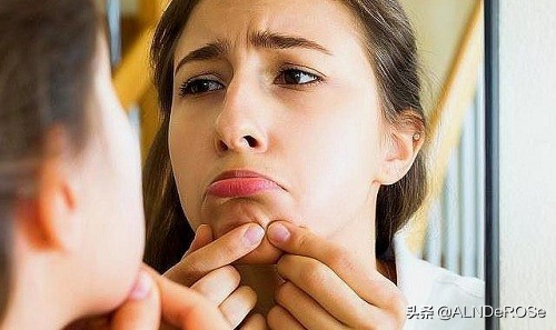 下巴长痘什么原因引起该如何调理,下巴长了一粒痘下巴都肿了怎么办