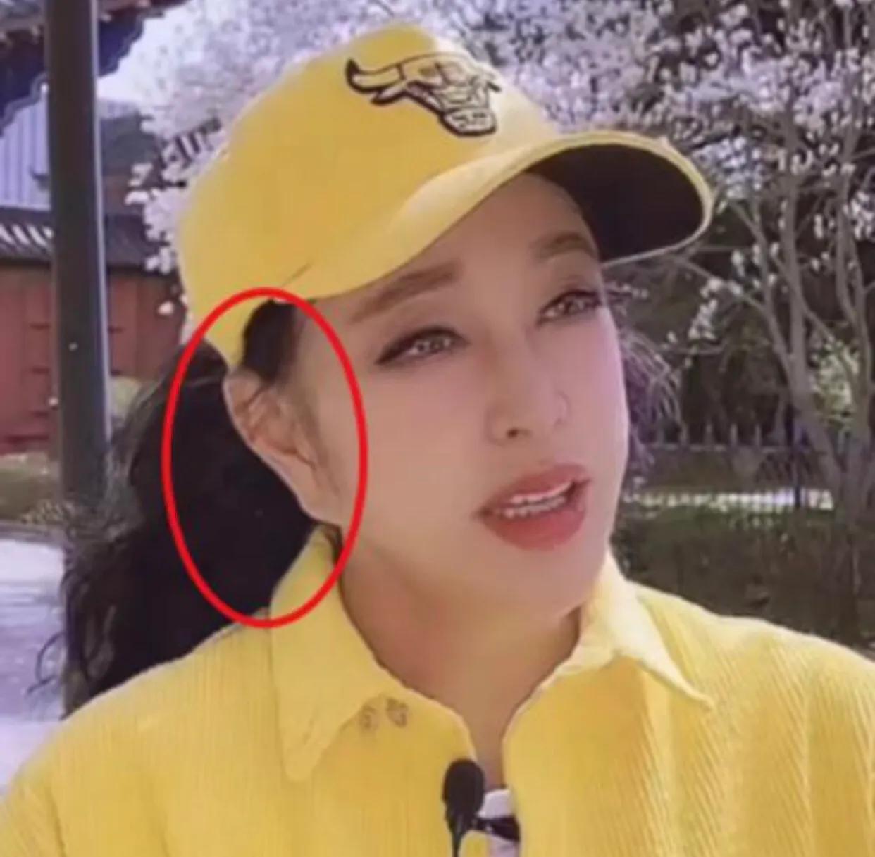 明星整容和不整容老去有什么区别,自然老去和整容明星的对比