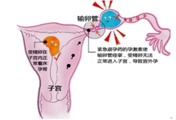 内分泌用药有哪些药品,紧急避孕药对内分泌的影响
