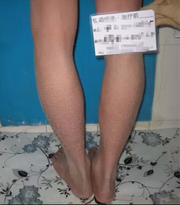 女友陪着康复,女友陪男友康复治疗