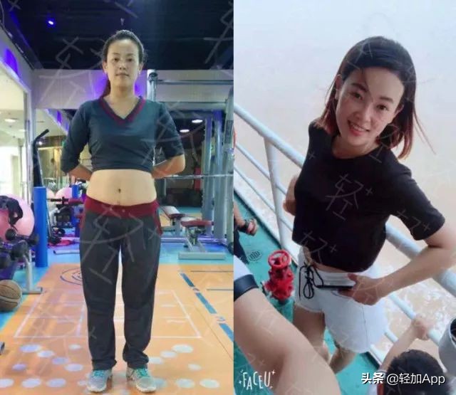 按摩减肥为啥能瘦下来,埋线减肥真的能瘦10斤吗