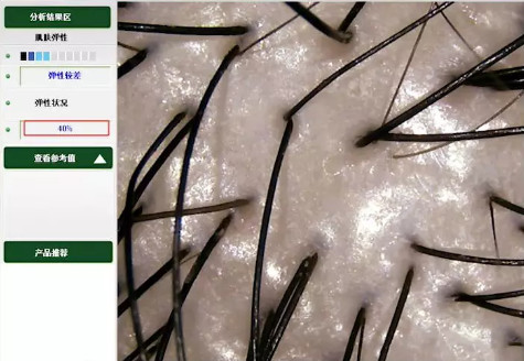 比较好用的德国防脱发,德国十大最好用的护肤品