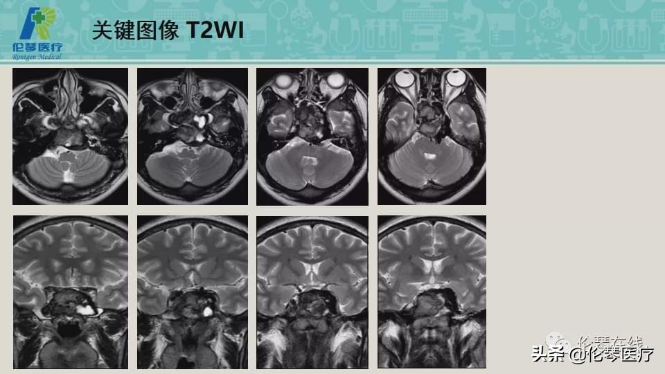 上海教授詹松华,上海曙光医院詹松华简介