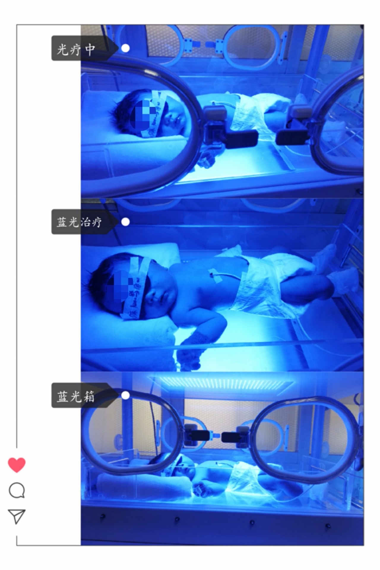 15日内婴儿黄疸自行调理方法,新生儿黄疸早上比下午高