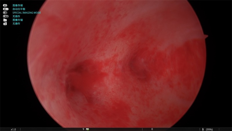 医联体再结硕果，南大一附院井冈山医院妇产科腔镜技术实现全面突破