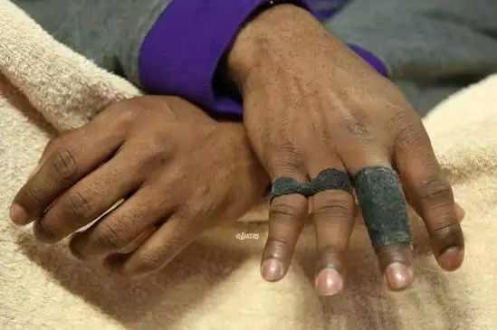 瞧瞧科比的手指，郑智的肚子，梅西C罗的脚，就会明白伟大不简单