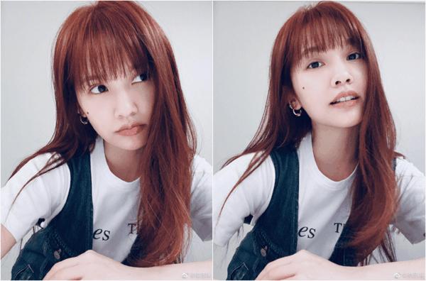 媒婆痣安崎,安崎要不要遮痣