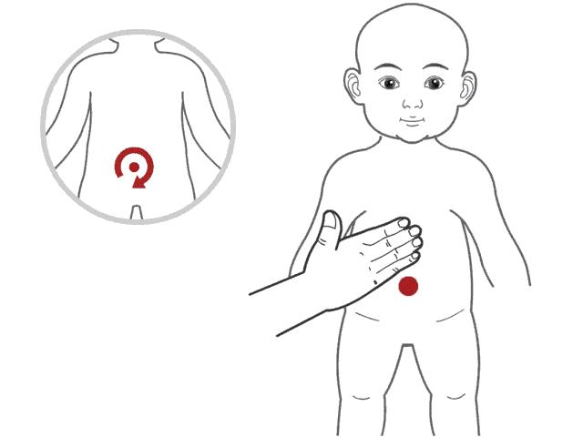 脾湿分两种,别再乱吃祛湿的东西了,(附详细推拿手法)