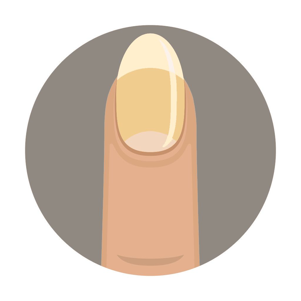 从医学角度，解读手相的秘密