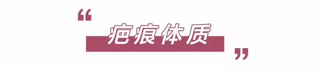 打三个耳洞有什么忌讳,三种人要打耳洞