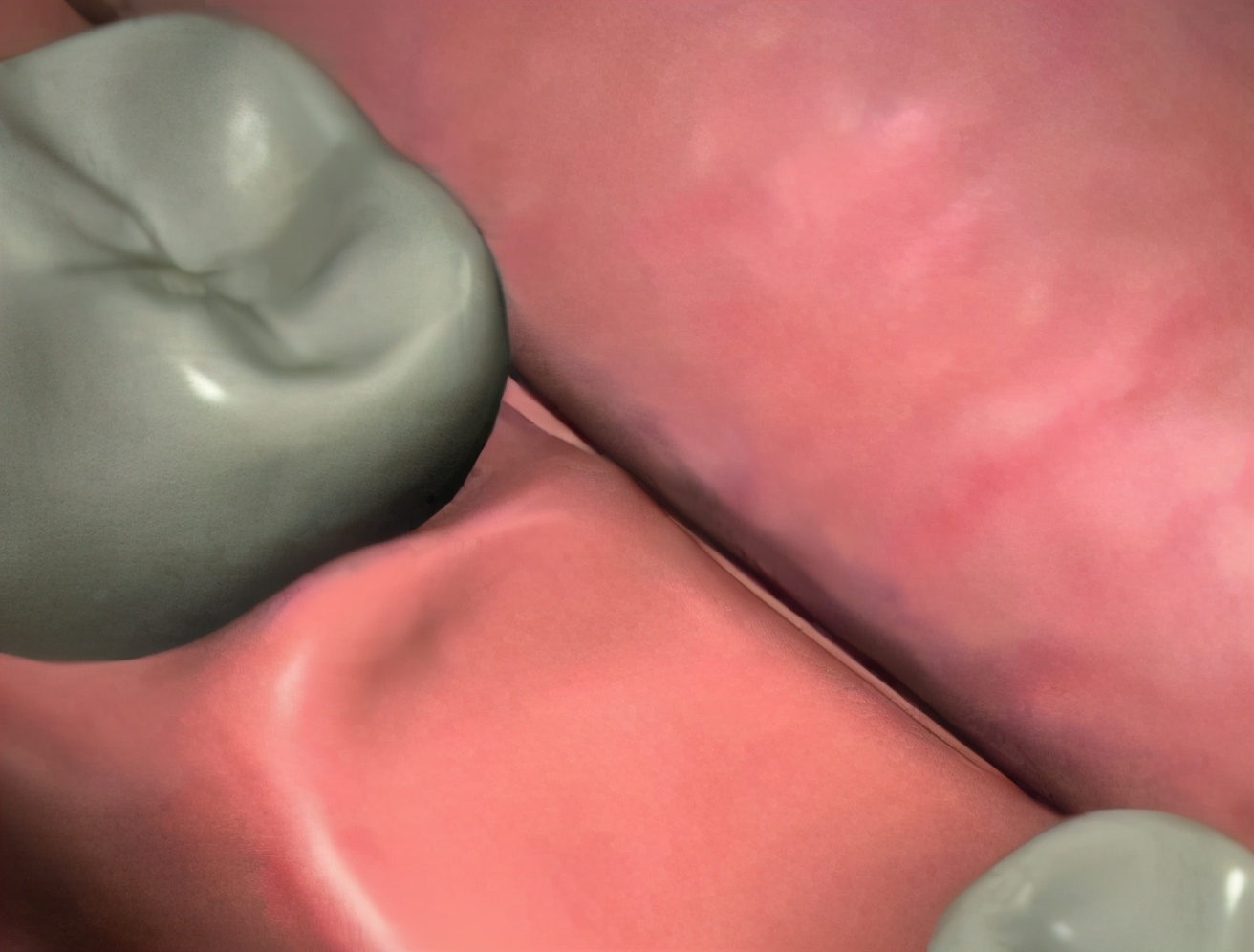 上海雅悦齿科种植牙价格,雅悦齿科医院简介