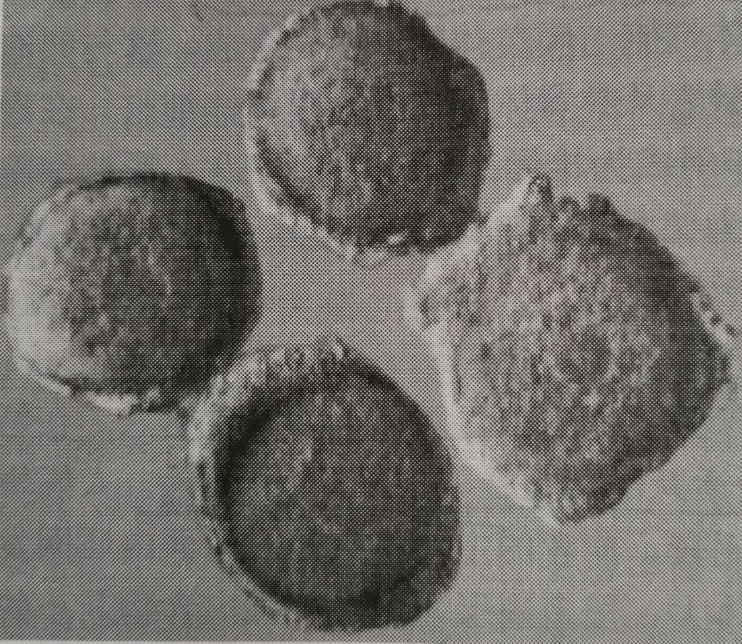 卵泡标准图片大全,微观卵泡是什么样子