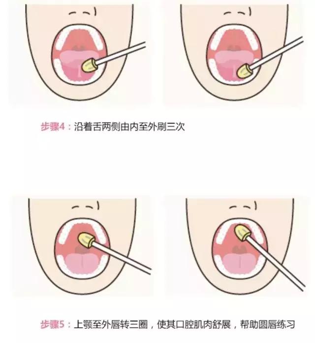 opt口肌评估,opt面部提拉
