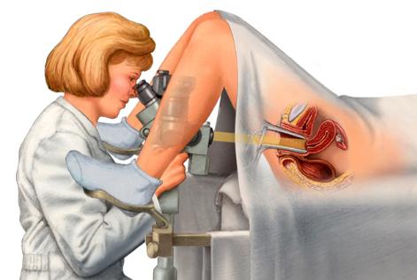 已婚女性定期应该做哪些检查,女人有没有性疾病查什么项目