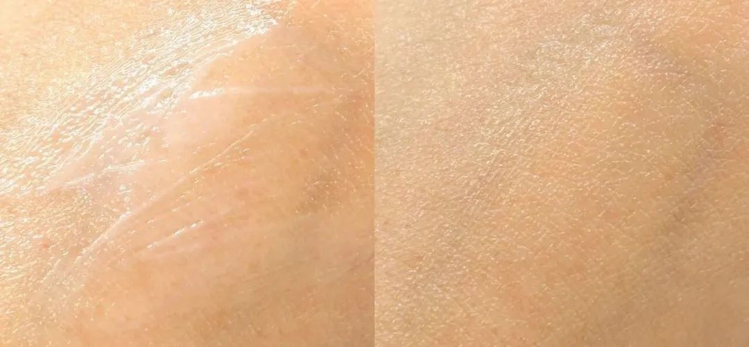 ems鎭㈠姝ｅ父浜嗕箞,ems鎭㈠浜嗗悧