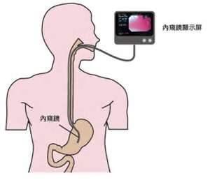 医生做肠胃镜全过程,顶级医院做胃镜
