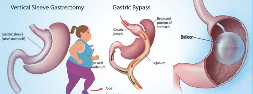 减肥那些事儿讲的是什么,减肥那些事儿简介