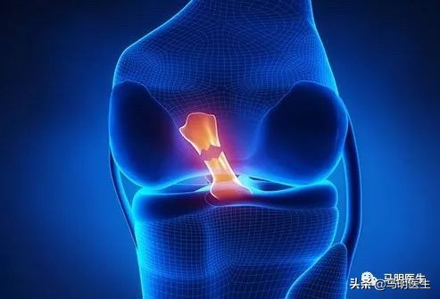 前交叉韧带损伤,ACLInjuries原因-双语学习