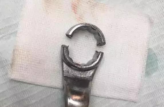 姑娘，我掏根管的时候，你舌头放尊重一点