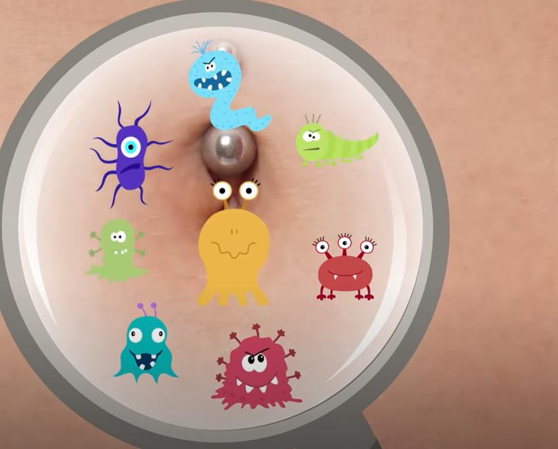 肚脐眼太脏了怎么处理,肚脐眼里面为啥有很多脏东西