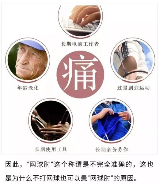 手肘忽然酸痛怎么缓解,手肘酸痛怎么办最快解决方法