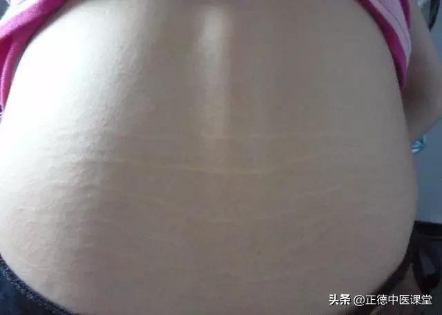 自诊肾虚,肾虚自诊