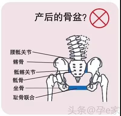摆脱大屁股恢复蜜桃臀，骨盆修复真的有用吗？