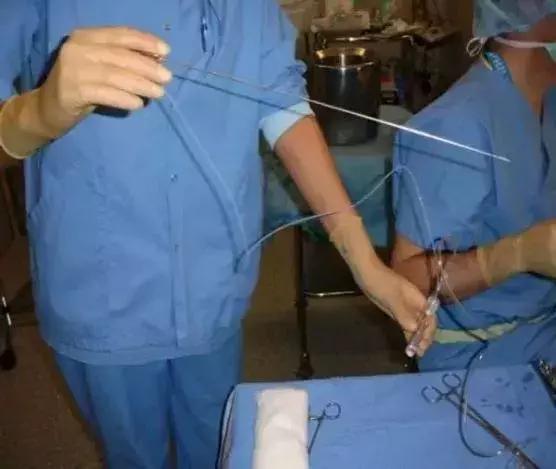 老公和婆婆背着儿媳，被“租子宫包生儿子”小广告骗了85万！活该