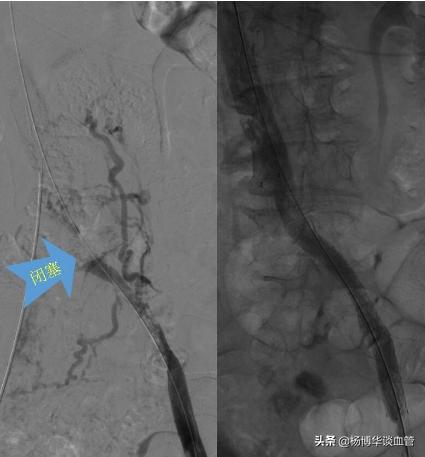 突然出现腿肿一定要当心,腿肿有小红点是什么原因