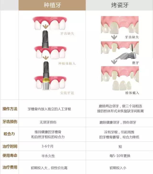 牙齿缺失一定要重视,牙齿缺失的三种解决方式