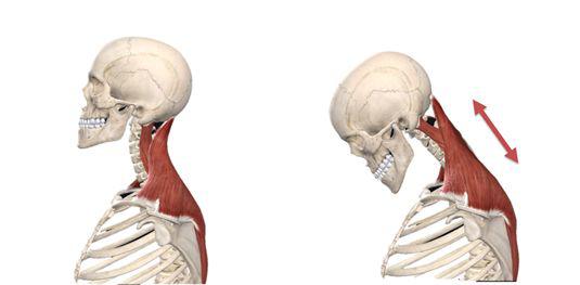 颈椎曲度康复案例,颈椎病康复科普文章图片