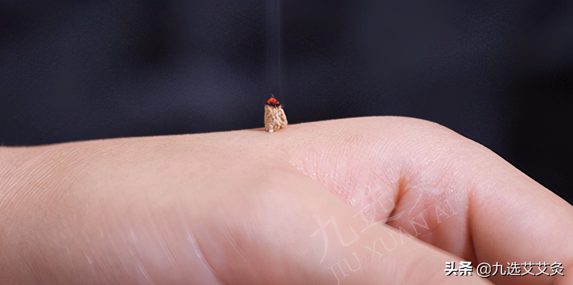 例假期间可以艾灸吗有什么副作用,艾灸有什么副作用