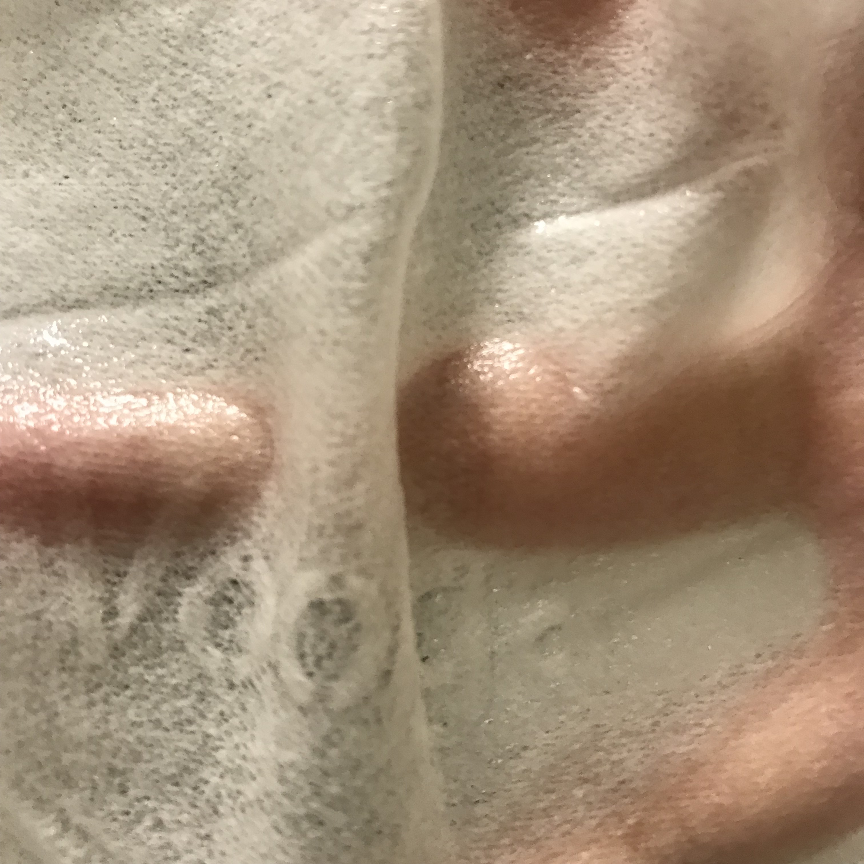 敏感肌*血丝红**终于有救了！敷尔佳新款绿膜，医美面膜王者不服不行