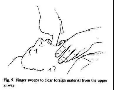 小孩吃东西呛到的最快解决方法,宝宝吃东西噎到急救视频