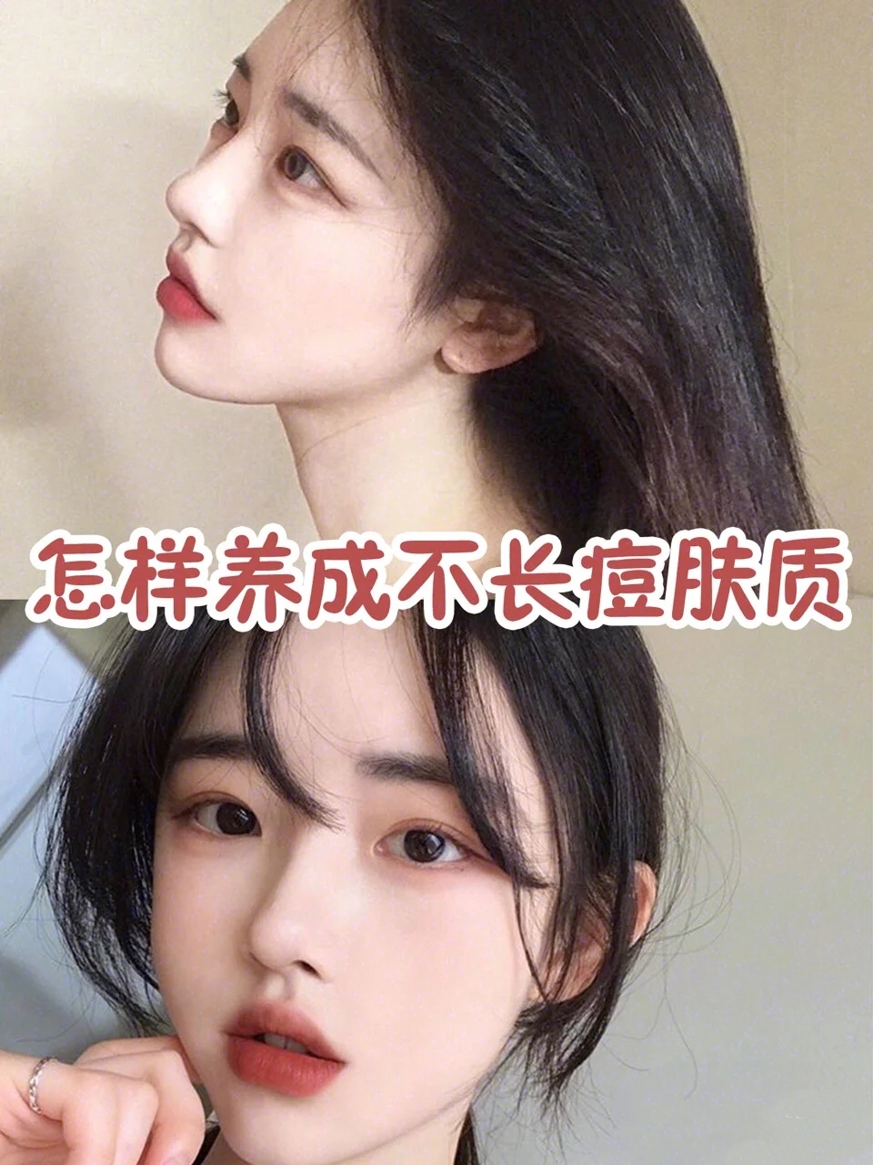 如何远离痘痘肌,远离痘痘的方法