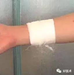 骨科急救处理流程图,骨科急救原则及注意事项