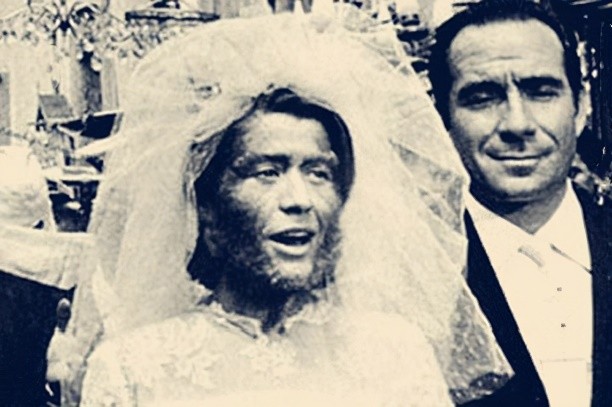 她身高1米38,拒绝20个求婚者,活着被当摇钱树,死后被做成标本