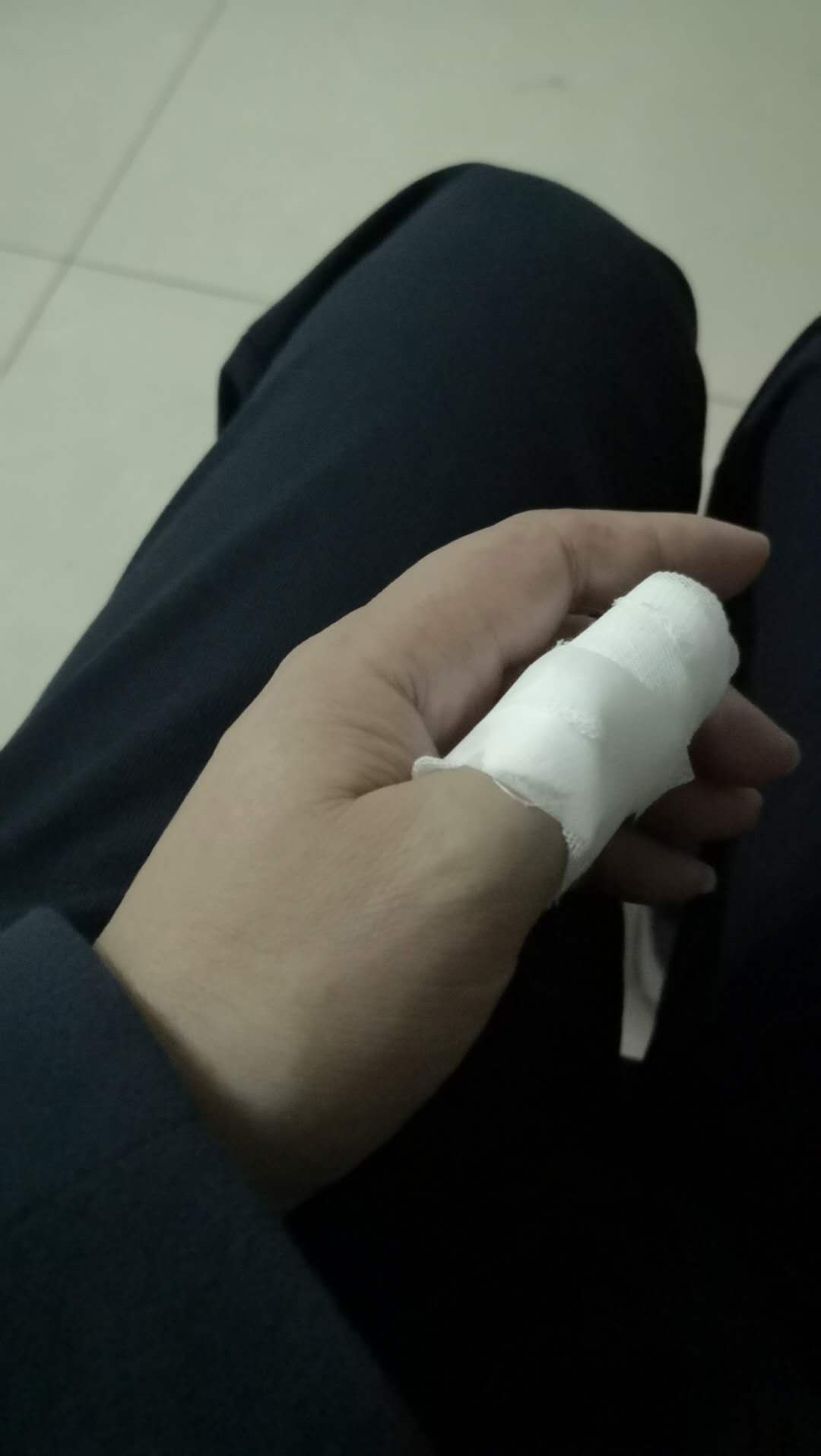 指甲一年换新几次？摔了一跤才得到了真实答案，纠正了想当然