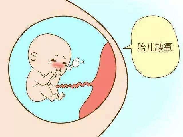 怀孕几周开始要做胎心监护,怀孕几周做胎心监护合适