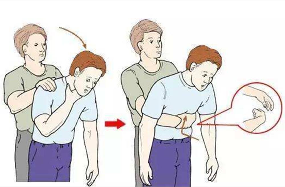 宝宝误食干燥剂的处理方法,宝宝误食了食品中的干燥剂