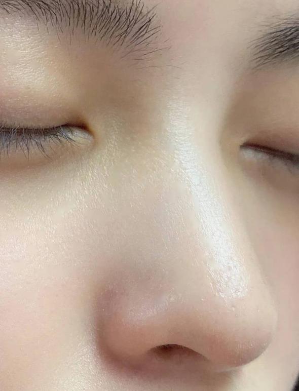 卸妆油对付黑头,家里卸妆产品用完了能用什么卸妆