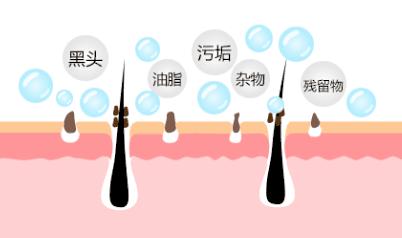 痘痘反反复复试试这招祛痘不用愁,青春期去除痘痘最有效的祛痘神器