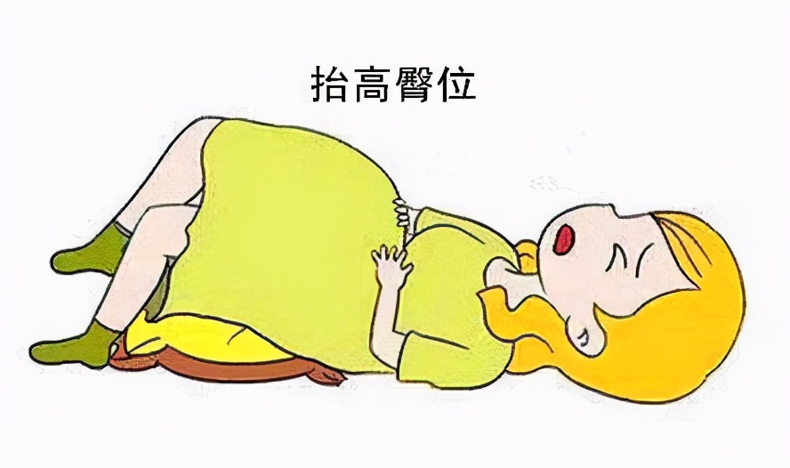 孕妇破水怎么办最有效的方法,孕妇破水了如何处理