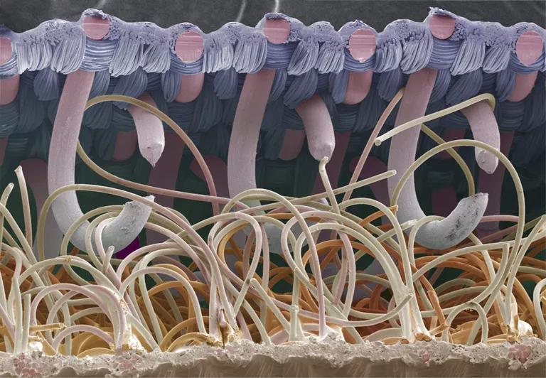 魔术贴的发明故事,魔术贴发明与什么有关