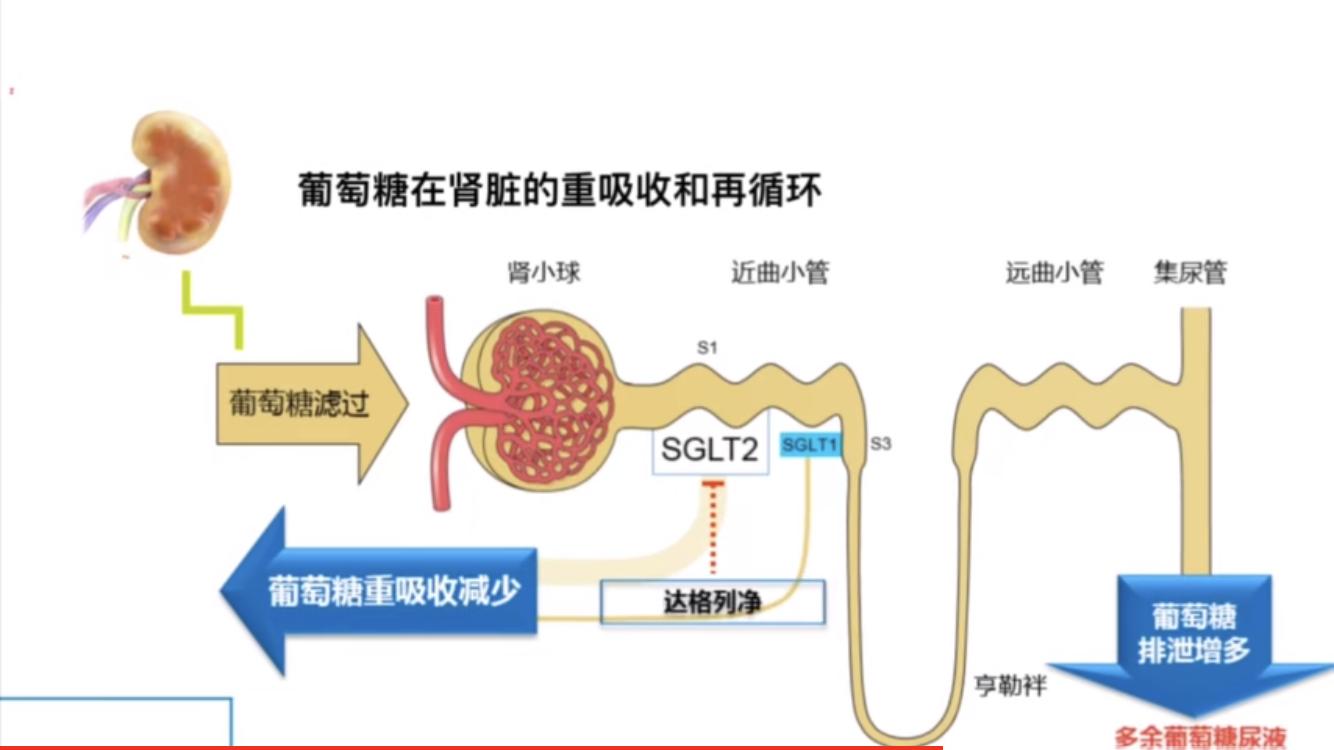 心梗吃达格列净,达格列净除了降糖还有什么作用
