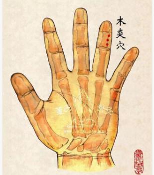 董氏奇穴木炎穴能双侧取穴吗,董氏奇穴去肝火从哪里放血