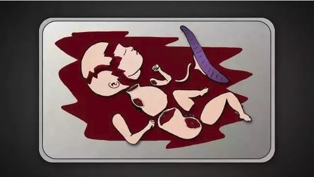 25岁的女生有几次打胎,女子堕胎6次连医生都惊讶了